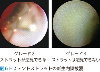 血管内イメージングパーフェクトガイド 【動画を含む電子版付】 – 日本